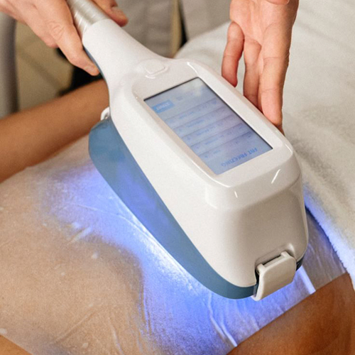 Кріоліполіз